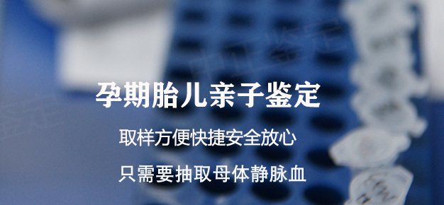 昆山产前亲子鉴定需要什么手续,昆山正规的孕期亲子鉴定中心在哪